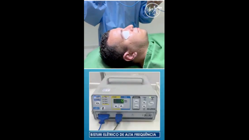 Procedimentos minimamente invasivos podem oferecer resultados sutis, mas a otoplastia ainda é a solução definitiva, afirma Milton Seigi Hayashi.